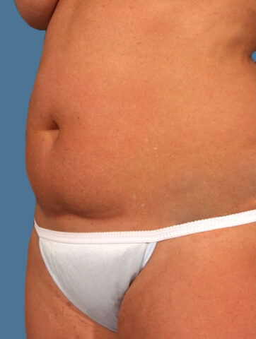 Case # 13 before photo