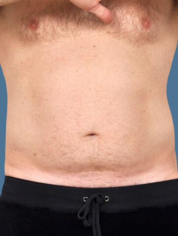 Case # 16 after photo