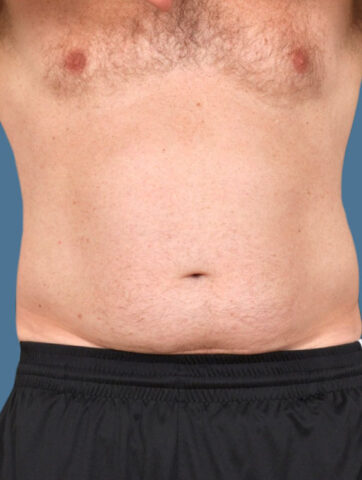 Case # 16 before photo