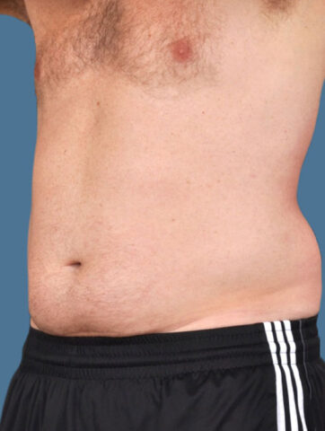 Case # 16 before photo