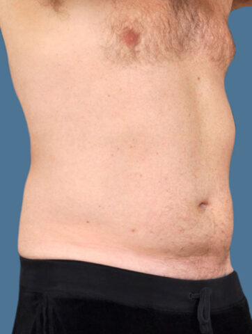 Case # 16 after photo