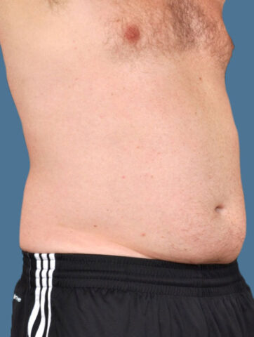 Case # 16 before photo