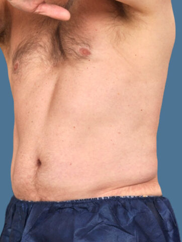 Case # 10 after photo