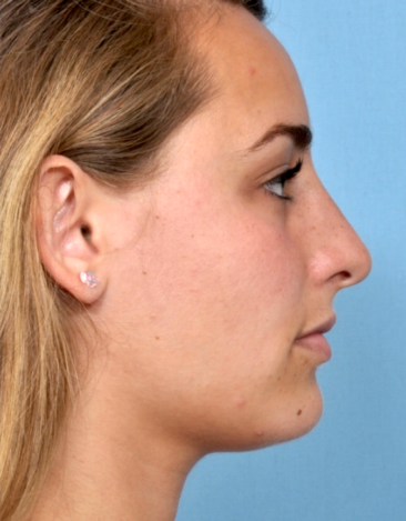 Case # 1 after photo