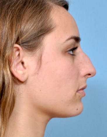 Case # 1 before photo