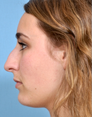 Case # 1 before photo