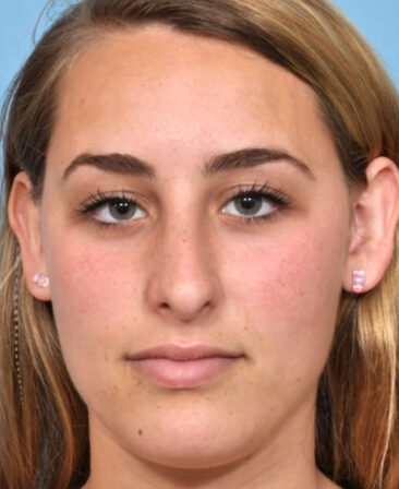 Case # 1 after photo