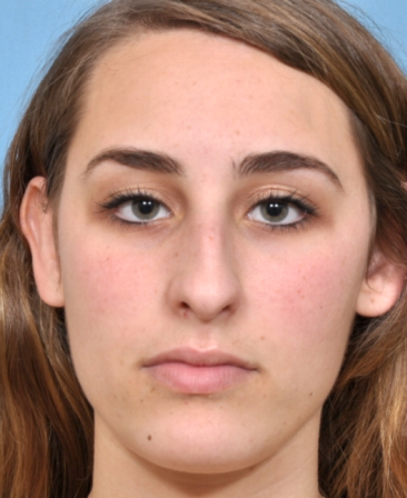 Case # 1 before photo