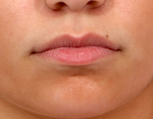 Case # 4 before photo