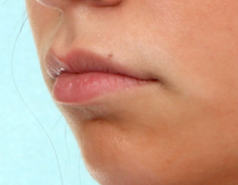 Case # 4 before photo