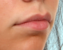 Case # 4 before photo