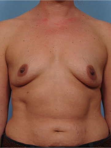 Case # 18 before photo