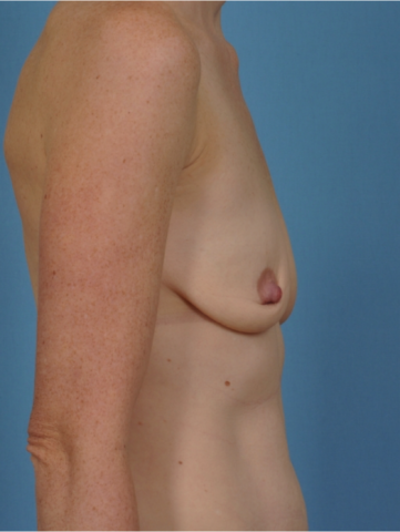 Case # 35 before photo