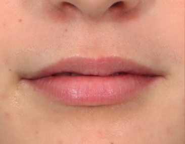 Case # 12 before photo