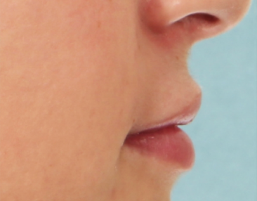 Case # 12 after photo