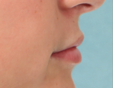 Case # 12 before photo