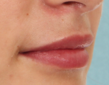 Case # 12 after photo