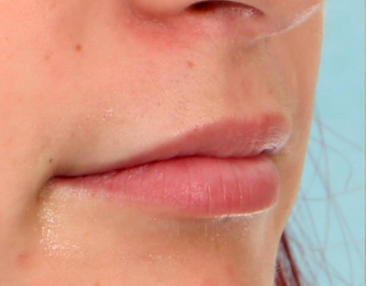 Case # 12 before photo