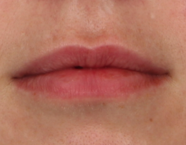 Case # 13 before photo