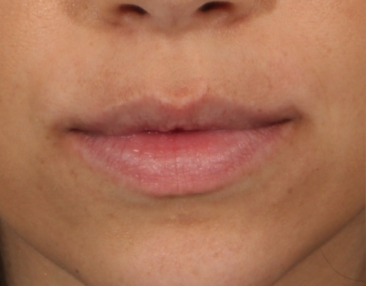 Case # 15 before photo