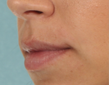 Case # 15 before photo