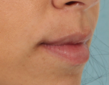 Case # 15 before photo