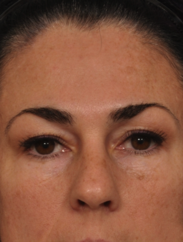 Case # 2 after photo