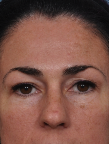 Case # 2 before photo