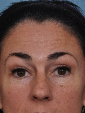 Case # 2 before photo