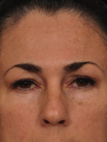 Case # 2 after photo