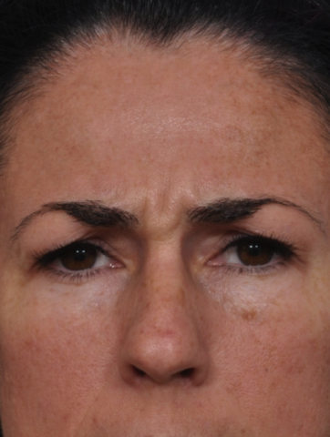 Case # 2 before photo