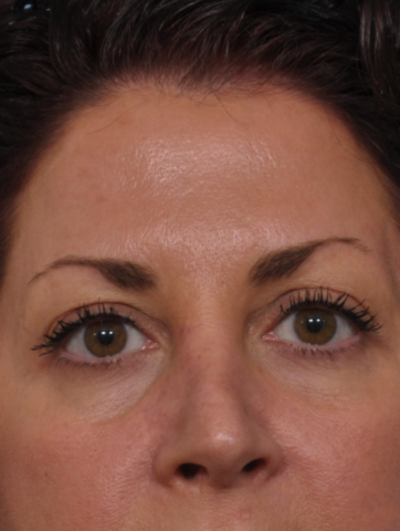 Case # 1 after photo