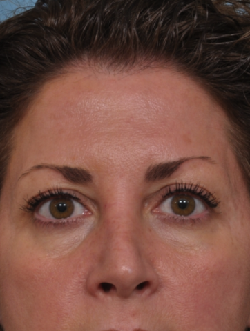 Case # 1 before photo