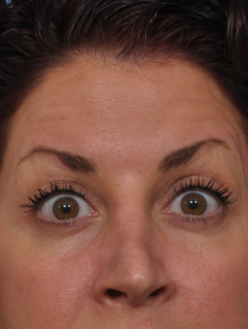 Case # 1 after photo