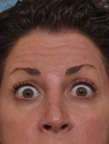 Case # 1 before photo