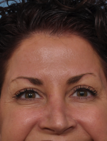 Case # 1 after photo