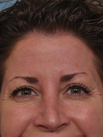 Case # 1 before photo