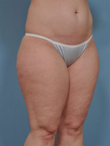 Case # 5 before photo