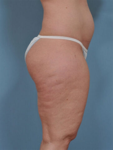 Case # 5 before photo