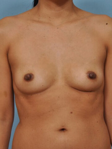 Case # 5 before photo