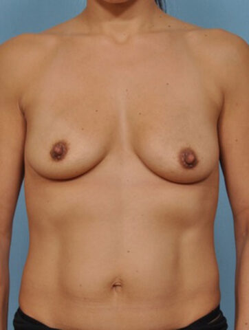 Case # 15 before photo