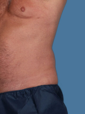 Case # 12 after photo