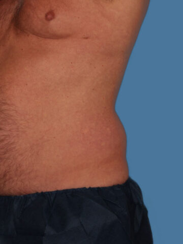 Case # 12 before photo