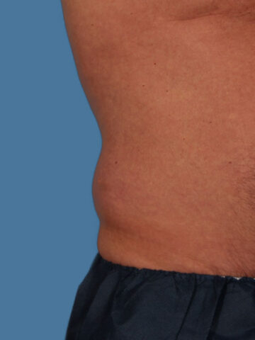 Case # 12 before photo