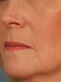 Case # 19 before photo