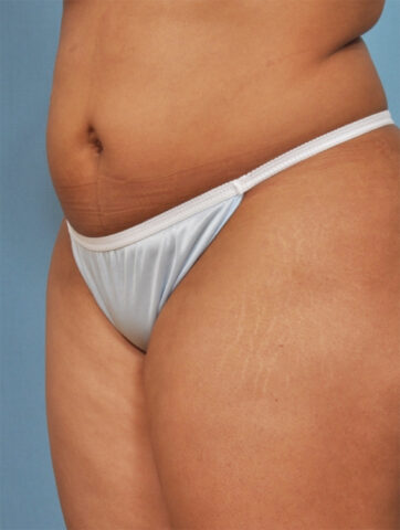 Case # 4 before photo