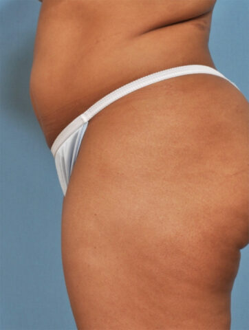 Case # 4 before photo