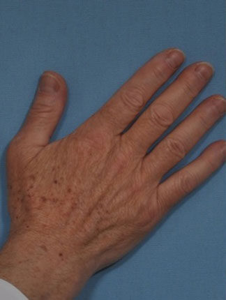 Case # 17 before photo