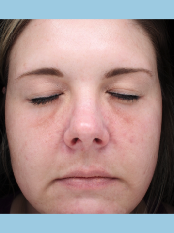 Case # 16 after photo