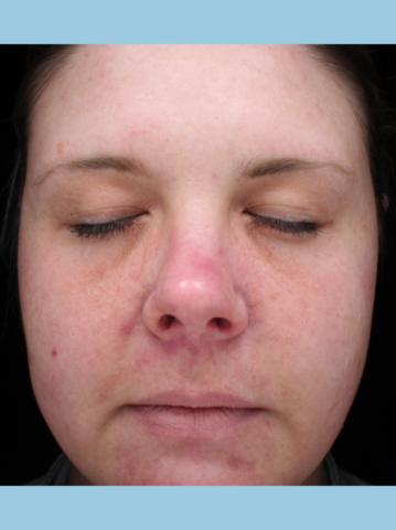 Case # 16 before photo